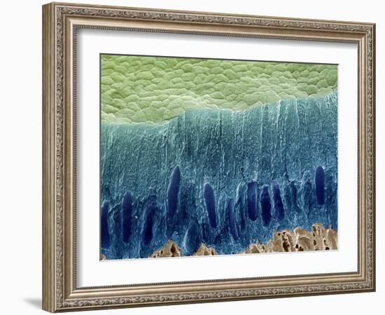 Tooth Enamel Formation, SEM-Steve Gschmeissner-Framed Photographic Print