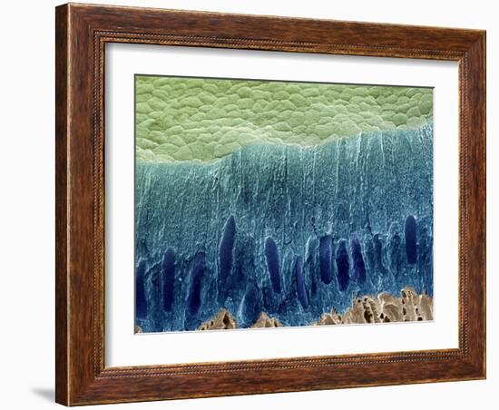 Tooth Enamel Formation, SEM-Steve Gschmeissner-Framed Photographic Print