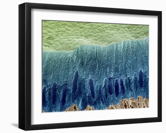 Tooth Enamel Formation, SEM-Steve Gschmeissner-Framed Photographic Print