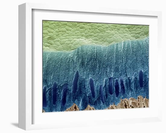 Tooth Enamel Formation, SEM-Steve Gschmeissner-Framed Photographic Print