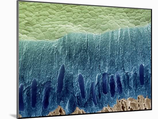 Tooth Enamel Formation, SEM-Steve Gschmeissner-Mounted Photographic Print
