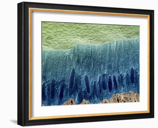 Tooth Enamel Formation, SEM-Steve Gschmeissner-Framed Photographic Print