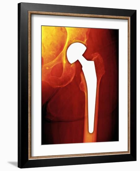 Total Hip Replacement, X-ray-Miriam Maslo-Framed Photographic Print