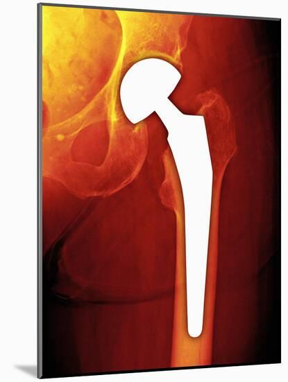 Total Hip Replacement, X-ray-Miriam Maslo-Mounted Photographic Print