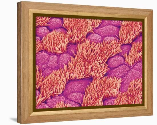 Trachea of a Rat-Micro Discovery-Framed Premier Image Canvas