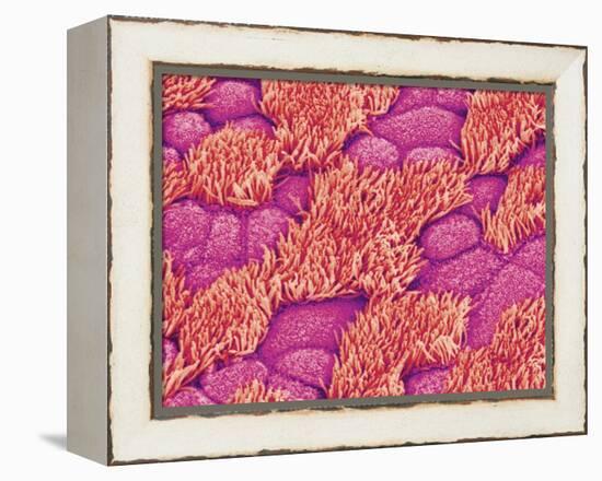 Trachea of a Rat-Micro Discovery-Framed Premier Image Canvas