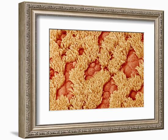 Trachea of a Rat-Micro Discovery-Framed Photographic Print