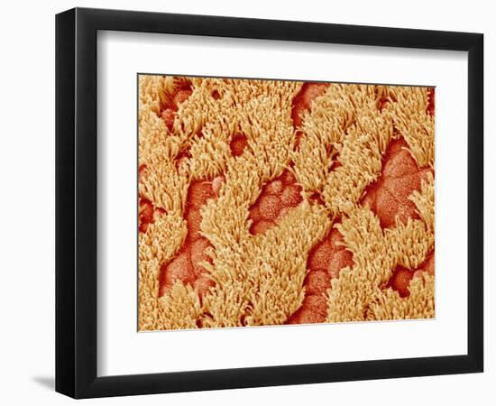 Trachea of a Rat-Micro Discovery-Framed Photographic Print