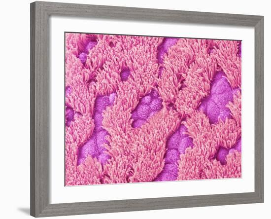 Trachea of a Rat-Micro Discovery-Framed Photographic Print