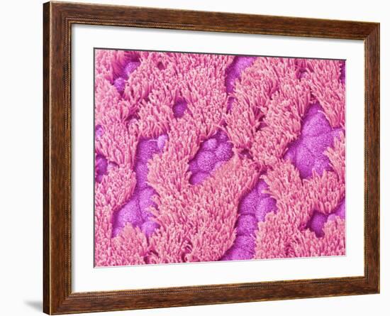 Trachea of a Rat-Micro Discovery-Framed Photographic Print