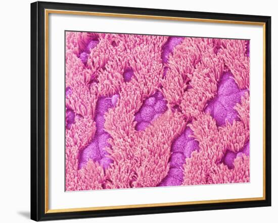 Trachea of a Rat-Micro Discovery-Framed Photographic Print