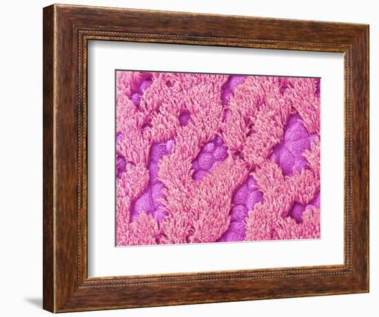 Trachea of a Rat-Micro Discovery-Framed Photographic Print