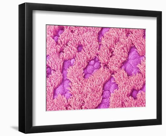 Trachea of a Rat-Micro Discovery-Framed Photographic Print