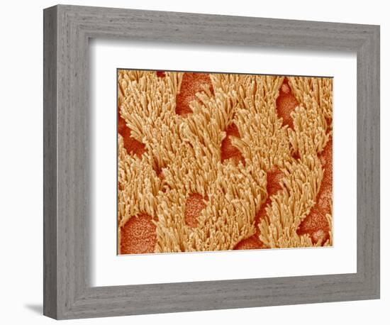 Trachea of a Rat-Micro Discovery-Framed Photographic Print