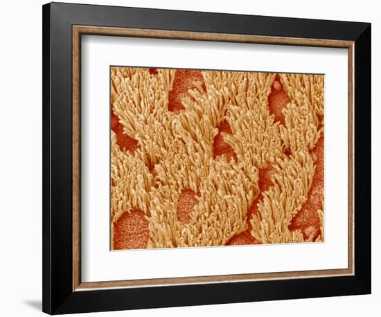 Trachea of a Rat-Micro Discovery-Framed Photographic Print