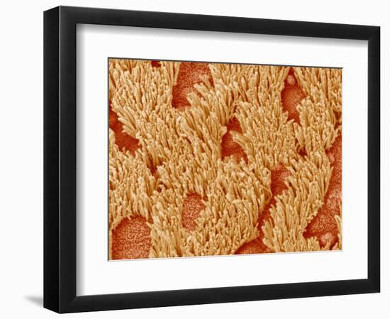 Trachea of a Rat-Micro Discovery-Framed Photographic Print