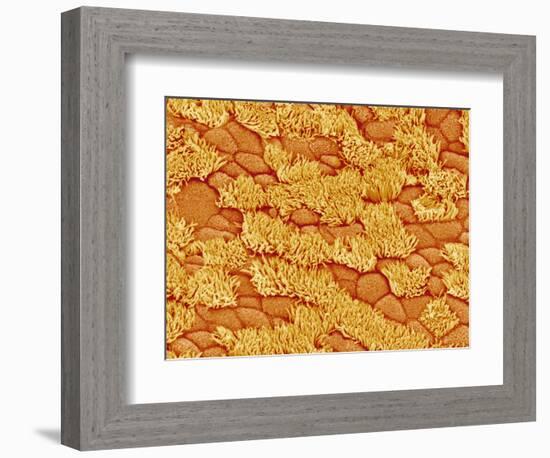 Trachea of a Rat-Micro Discovery-Framed Photographic Print