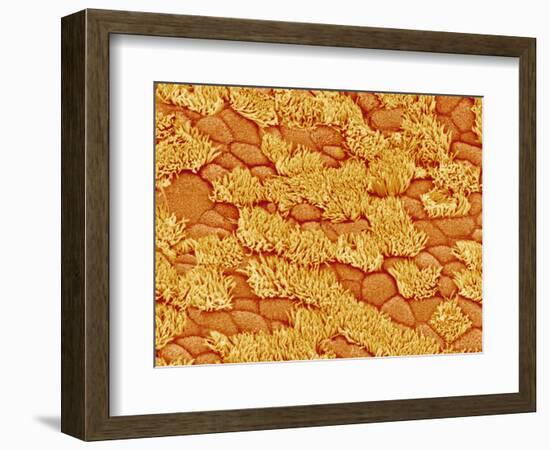 Trachea of a Rat-Micro Discovery-Framed Photographic Print