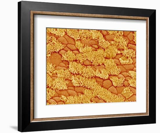 Trachea of a Rat-Micro Discovery-Framed Photographic Print