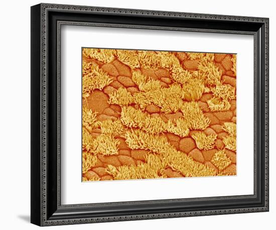 Trachea of a Rat-Micro Discovery-Framed Photographic Print