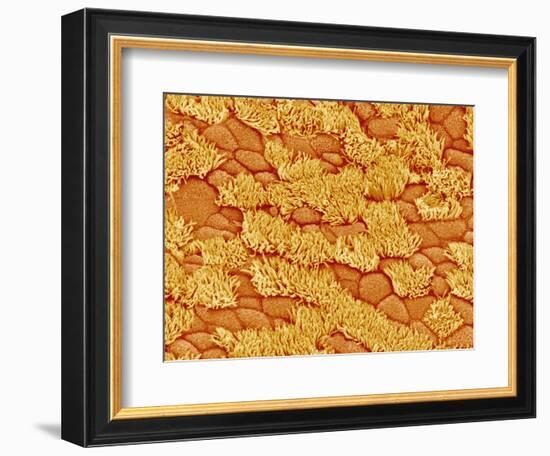 Trachea of a Rat-Micro Discovery-Framed Photographic Print