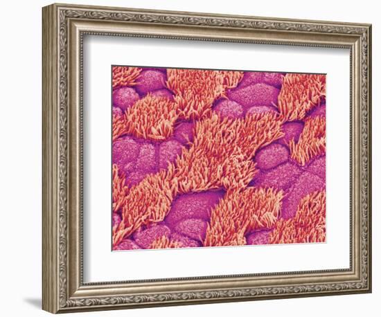 Trachea of a Rat-Micro Discovery-Framed Photographic Print