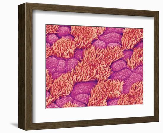 Trachea of a Rat-Micro Discovery-Framed Photographic Print