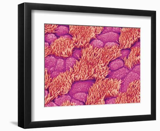 Trachea of a Rat-Micro Discovery-Framed Photographic Print