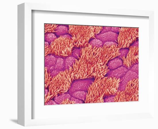 Trachea of a Rat-Micro Discovery-Framed Photographic Print