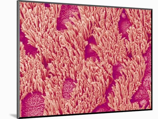 Trachea of a Rat-Micro Discovery-Mounted Photographic Print