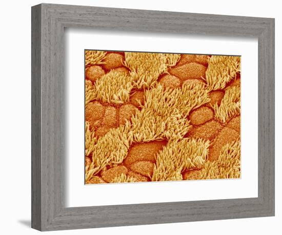 Trachea of a Rat-Micro Discovery-Framed Photographic Print