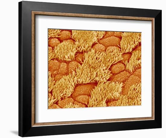 Trachea of a Rat-Micro Discovery-Framed Photographic Print