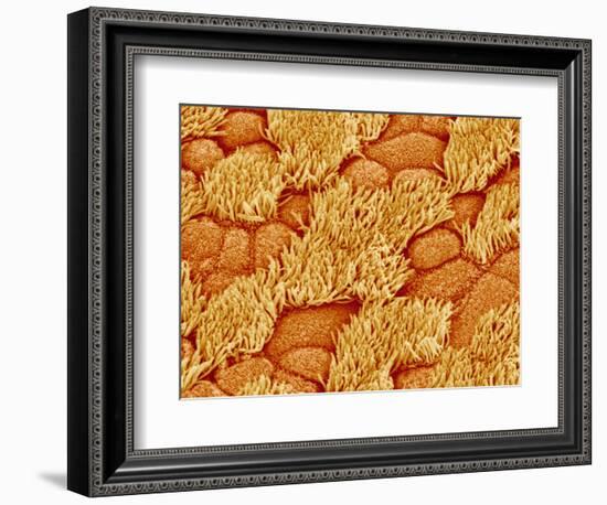 Trachea of a Rat-Micro Discovery-Framed Photographic Print