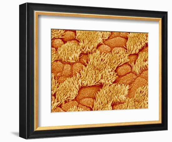 Trachea of a Rat-Micro Discovery-Framed Photographic Print