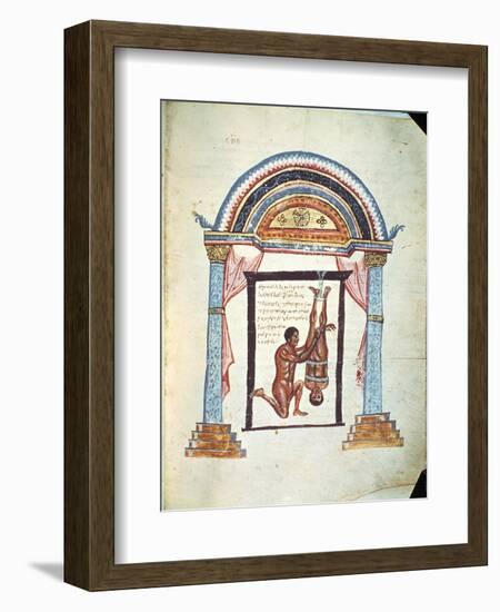 Treatment of a Dislocation, from a Commentary on the Hippocratic Treatise "On Joints"-null-Framed Giclee Print