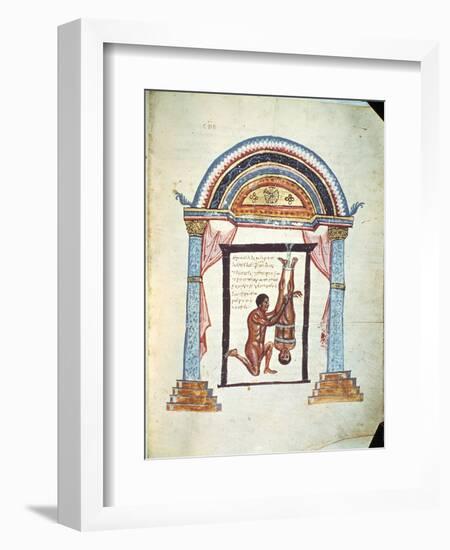 Treatment of a Dislocation, from a Commentary on the Hippocratic Treatise "On Joints"-null-Framed Giclee Print