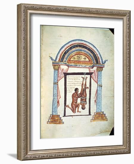 Treatment of a Dislocation, from a Commentary on the Hippocratic Treatise "On Joints"-null-Framed Giclee Print