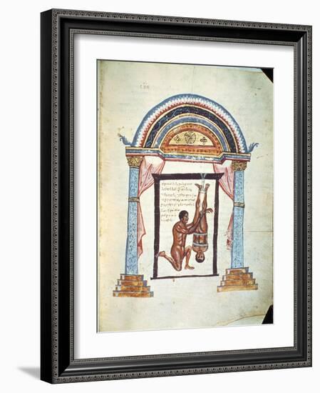 Treatment of a Dislocation, from a Commentary on the Hippocratic Treatise "On Joints"-null-Framed Giclee Print