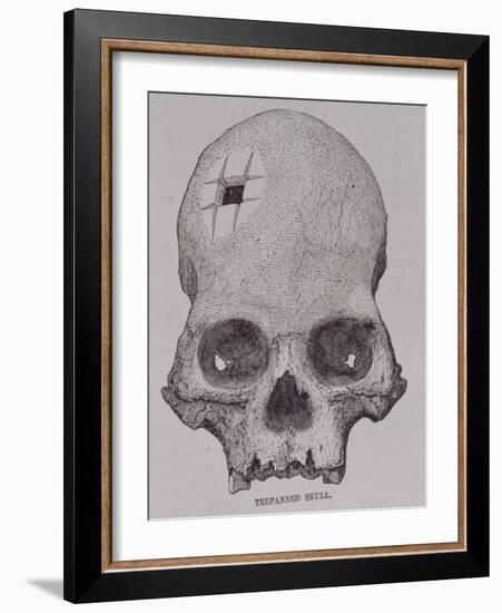 Trepanned Skull, from Incidents of Travel and Exploration in the Land of the Incas-null-Framed Giclee Print