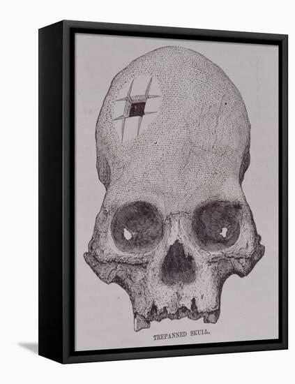 Trepanned Skull, from Incidents of Travel and Exploration in the Land of the Incas-null-Framed Premier Image Canvas