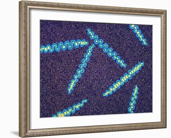 Treponema Pallidum Bacteria-null-Framed Photographic Print