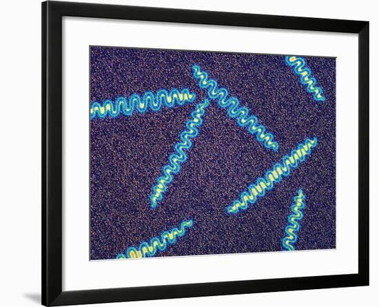 Treponema Pallidum Bacteria-null-Framed Photographic Print