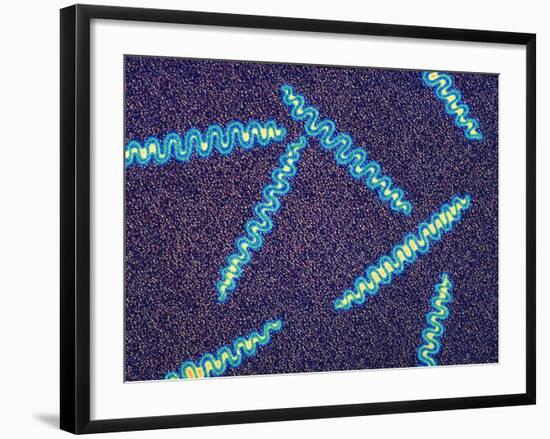 Treponema Pallidum Bacteria-null-Framed Photographic Print