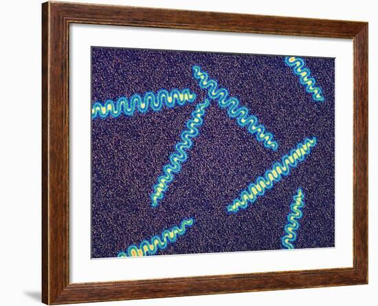 Treponema Pallidum Bacteria-null-Framed Photographic Print