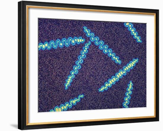 Treponema Pallidum Bacteria-null-Framed Photographic Print