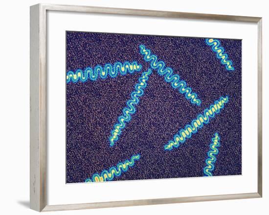 Treponema Pallidum Bacteria-null-Framed Photographic Print