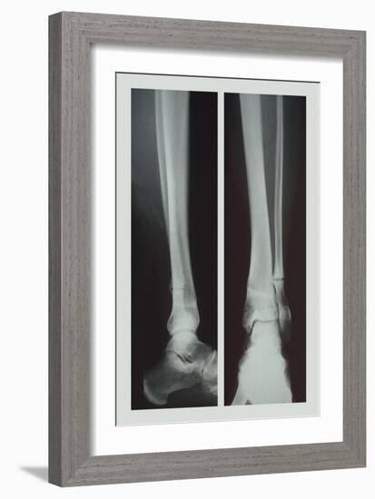 Two Ankles-null-Framed Premium Giclee Print