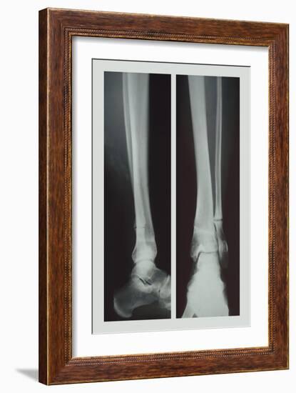 Two Ankles-null-Framed Premium Giclee Print