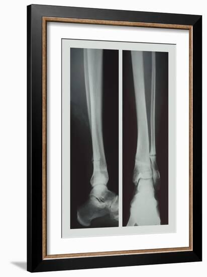 Two Ankles-null-Framed Premium Giclee Print