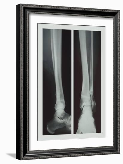 Two Ankles-null-Framed Premium Giclee Print